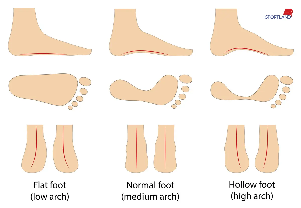 انواع مختلف کف پا